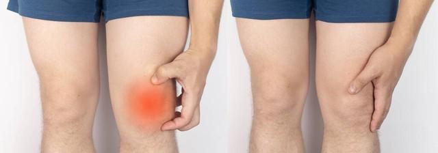 王超, AA, 很多膝关节 王超, AA, 很多膝关节